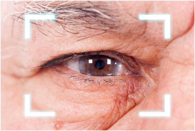 Cataract surgery