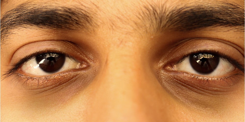 oculoplastic surgeon mumbai